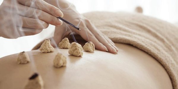 moxibustion