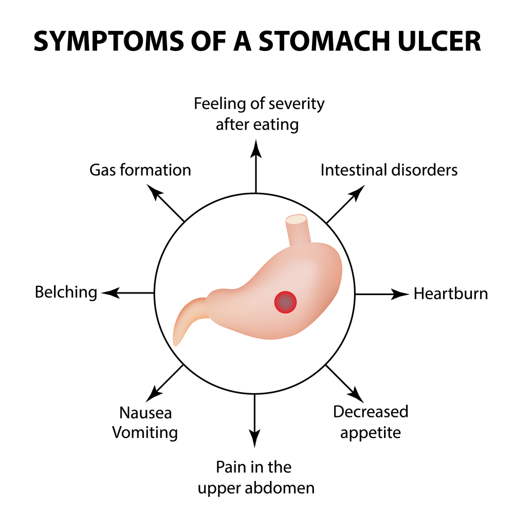 Peptic Ulcer Treatment
